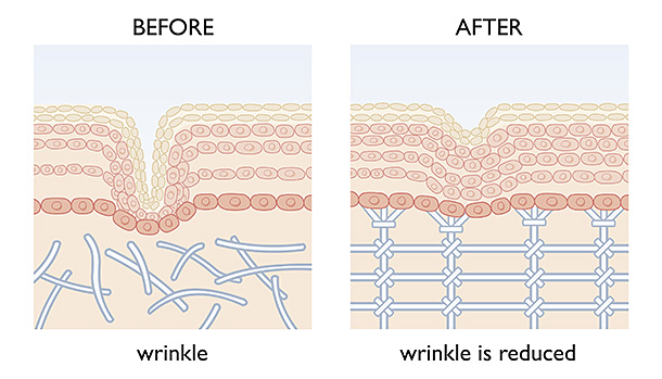 2006.09_oriflame_diagram